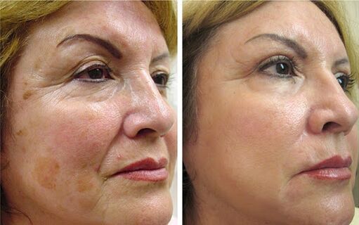Anna from Wroclaw has a noticeable effect by smoothing out wrinkles and tightening the face contour after using Canabilab