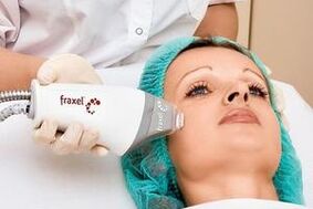 laser fractional facial skin rejuvenation
